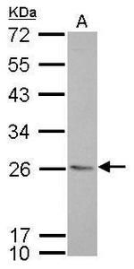 CD74 Antibody in Western Blot (WB)