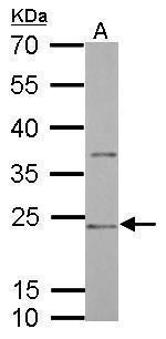 CD74 Antibody in Western Blot (WB)