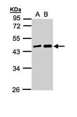 MAGEA11 Antibody in Western Blot (WB)