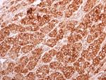 eIF5A2 Antibody in Immunohistochemistry (Paraffin) (IHC (P))