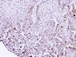 TACC2 Polyclonal Antibody