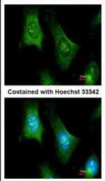 PTS Polyclonal Antibody