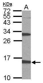 PTS Antibody in Western Blot (WB)