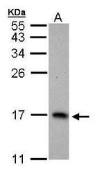 PTS Antibody in Western Blot (WB)
