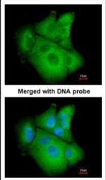 PSAT1 Polyclonal Antibody