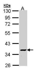 ATP6V1C2 Polyclonal Antibody