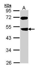 FBXL3 Antibody in Western Blot (WB)