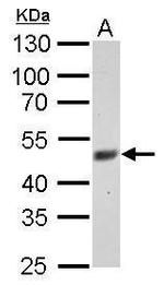 FBXL3 Antibody in Western Blot (WB)
