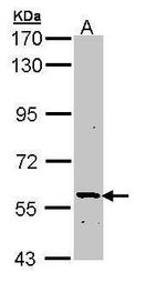 PLA2G3 Polyclonal Antibody