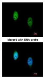 TBLR1 Polyclonal Antibody