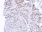 TBLR1 Antibody in Immunohistochemistry (Paraffin) (IHC (P))