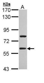 TBLR1 Antibody in Western Blot (WB)