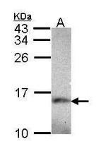 NDUFA5 Antibody in Western Blot (WB)