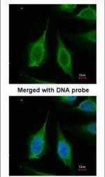 PPA1 Polyclonal Antibody