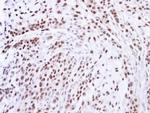 ZNF346 Antibody in Immunohistochemistry (Paraffin) (IHC (P))