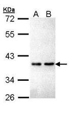 ZNF346 Antibody in Western Blot (WB)