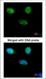 MCM3 Polyclonal Antibody