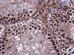 PIK3CB Antibody in Immunohistochemistry (Paraffin) (IHC (P))