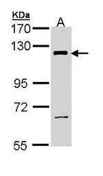 PIK3CB Antibody in Western Blot (WB)