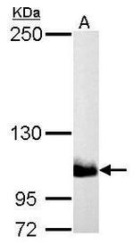 PIK3CB Antibody in Western Blot (WB)
