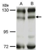 PIK3CB Antibody in Western Blot (WB)
