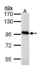 ATP6V0A4 Polyclonal Antibody
