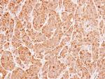 UNC13B Antibody in Immunohistochemistry (Paraffin) (IHC (P))