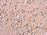 PKC alpha Polyclonal Antibody