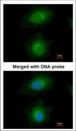 MVD Polyclonal Antibody