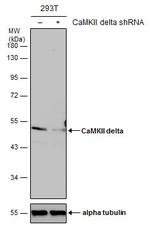 CaMKII delta Antibody in Western Blot (WB)