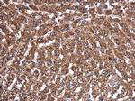 MVD Polyclonal Antibody
