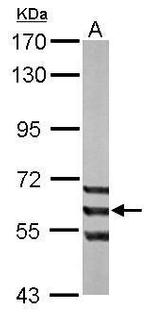 ADCK1 Antibody in Western Blot (WB)