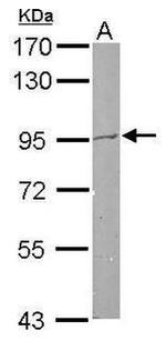 PRPF4B Antibody in Western Blot (WB)
