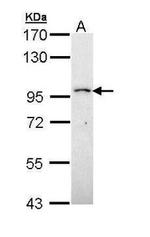 PRPF4B Antibody in Western Blot (WB)