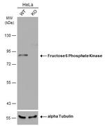 PFKM Polyclonal Antibody