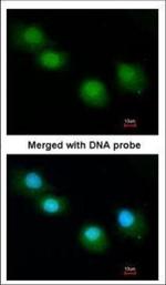 Ubiquilin 1 Polyclonal Antibody