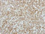 EEF2K Polyclonal Antibody
