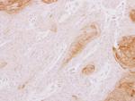 TXNDC3 Polyclonal Antibody