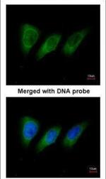 PKN2 Polyclonal Antibody