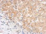 Complement C5 Polyclonal Antibody