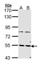 PDE1A Antibody in Western Blot (WB)