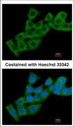 CHP1 Polyclonal Antibody