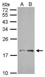 NDUFAB1 Antibody in Western Blot (WB)