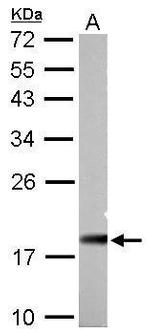 NDUFAB1 Antibody in Western Blot (WB)