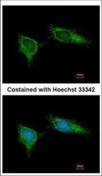 NDUFB5 Polyclonal Antibody