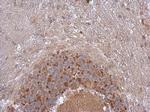 NDUFB5 Antibody in Immunohistochemistry (Paraffin) (IHC (P))