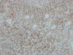 NDUFB5 Antibody in Immunohistochemistry (Paraffin) (IHC (P))