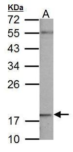 NDUFB5 Antibody in Western Blot (WB)