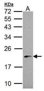 NDUFB5 Antibody in Western Blot (WB)