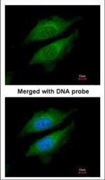 DPP8 Polyclonal Antibody